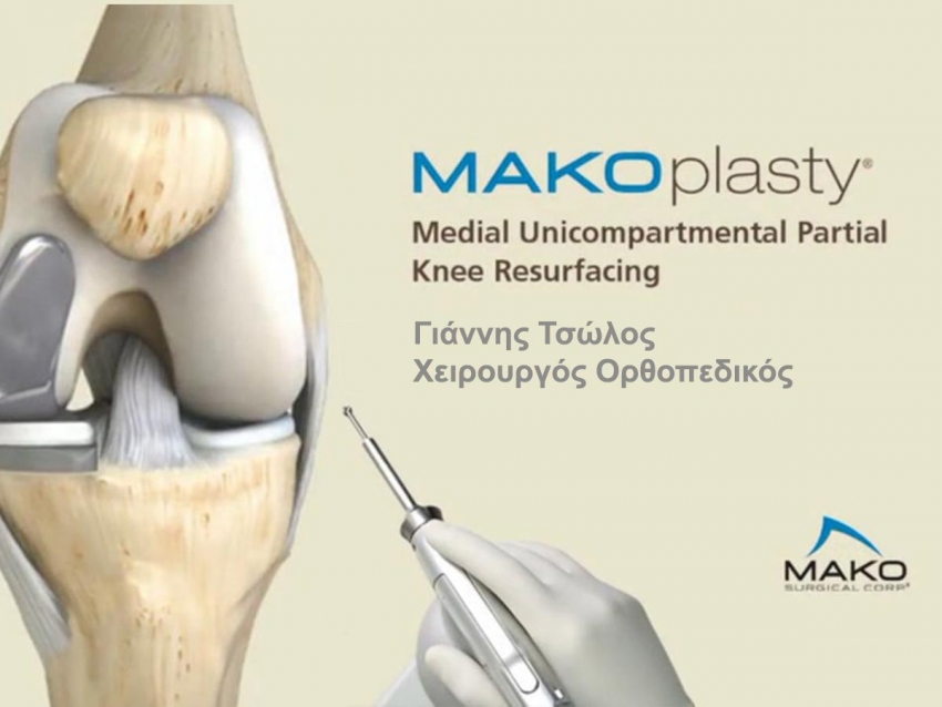 MAKOplasty® Partial Knee Resurfacing